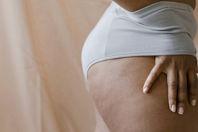 Ciało kobiety, która zmaga się z cellulitem wodnym